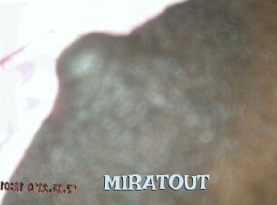 MIRATOUT Hairy old snatch